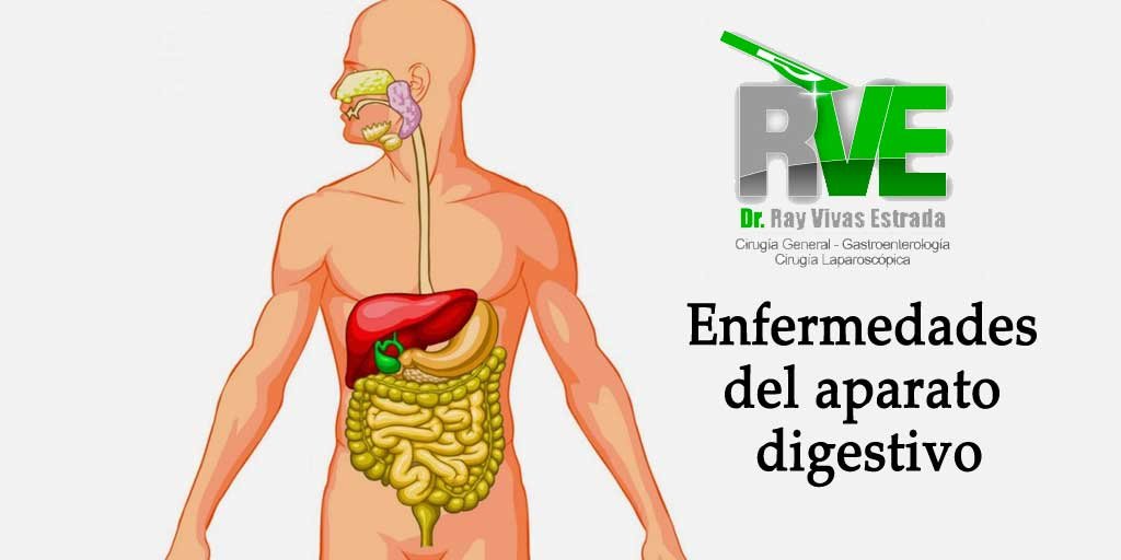 Enfermedades Del Aparato Digestivo Dr Ray Vivas